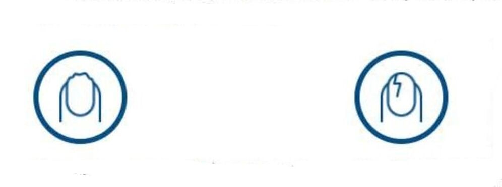 nagu deformācija sēnīšu infekcijas dēļ